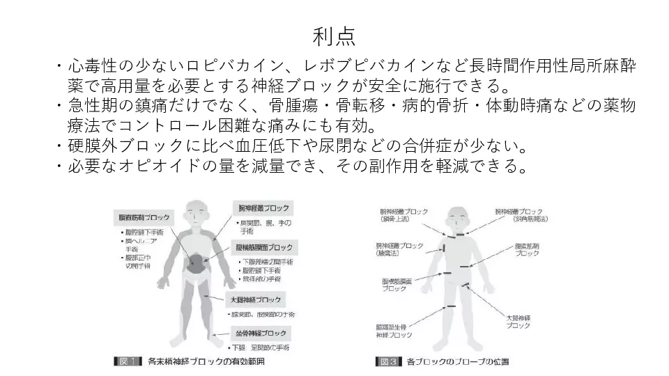 麻酔と術後鎮痛基本のキ・・・これで安心術後疼痛管理 | Dr.'s Prime
