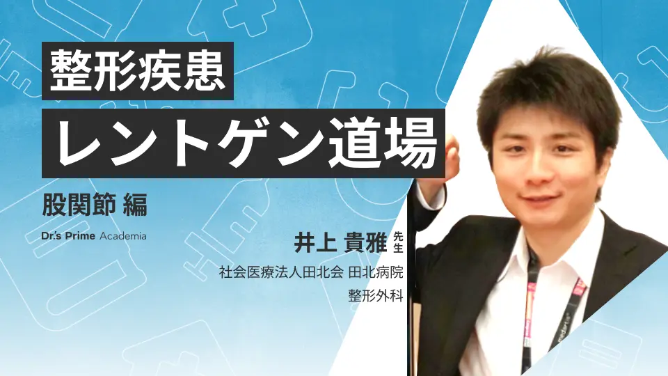 整形疾患 レントゲン道場~股関節~