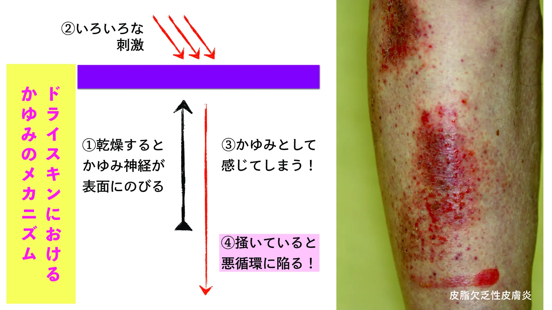これだけは押さえよう！診療でよく出会う皮膚病7選 | Dr.'s Prime