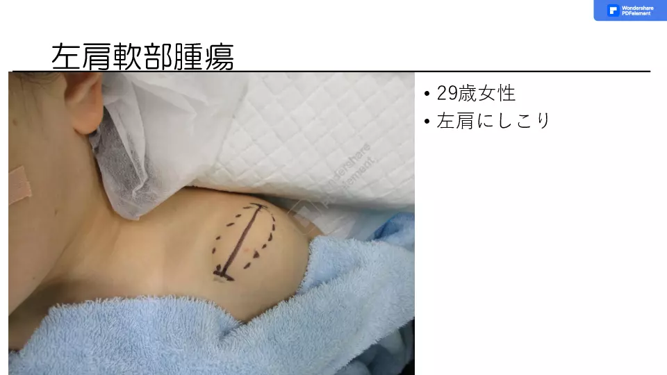 しこりをみたら〜しこり治療の基礎から応用まで〜 | Dr.'s Prime