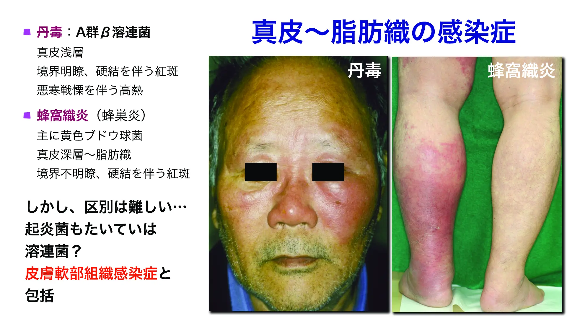 これだけは押さえよう！診療でよく出会う皮膚病7選 | Dr.'s Prime
