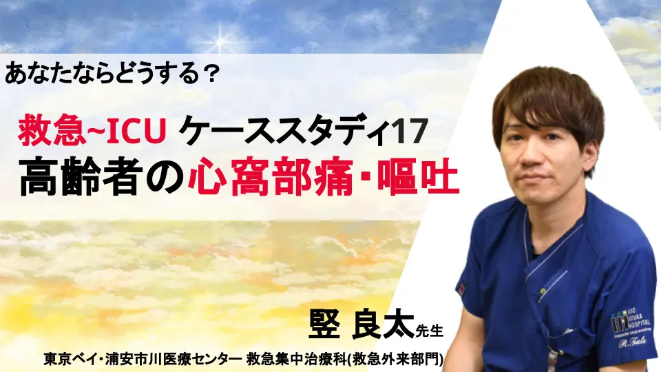あなたならどうする？救急-ICU ケーススタディ17「高齢者の心窩部痛・嘔吐」