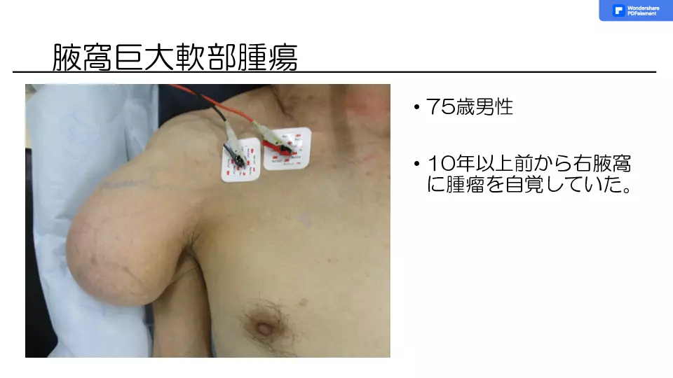 裁断済み　しこりをみたらどう考える？ 日常診療で遭遇するしこりへの対応法 しこりをみたら〜しこり治療の基礎から応用まで〜 | Dr.'s Prime