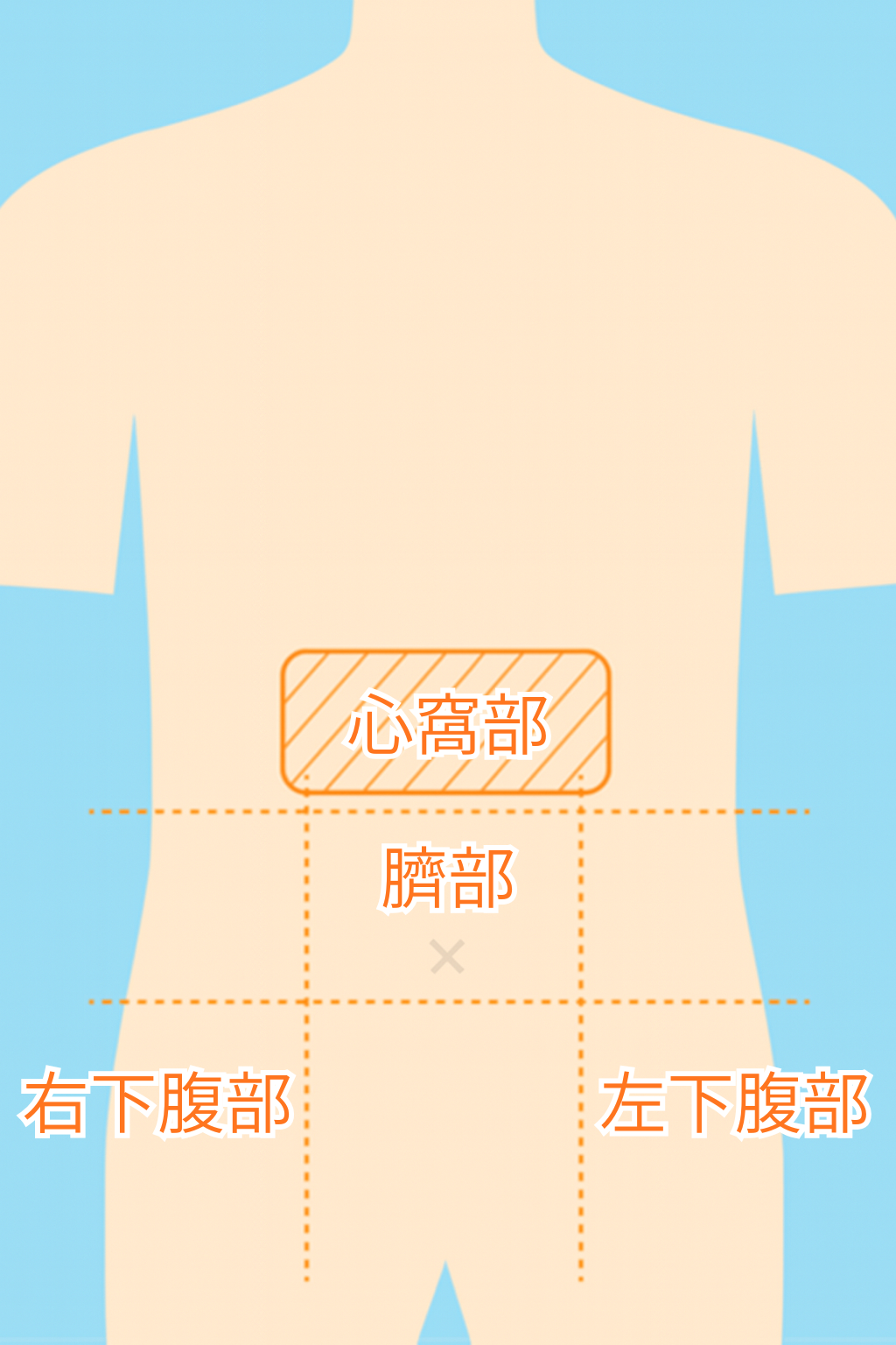 腹痛の部位と病気