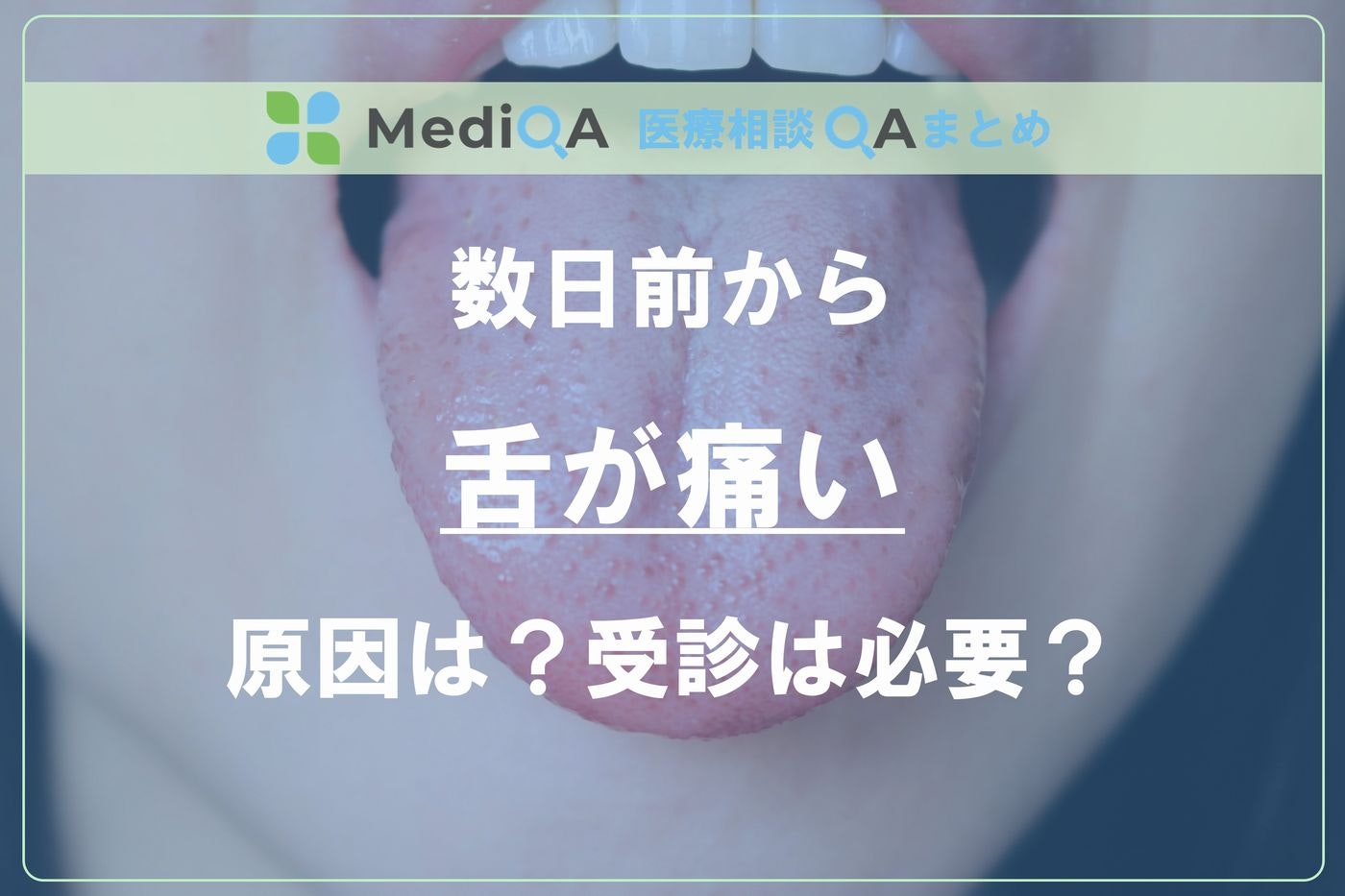 アイキャッチ画像