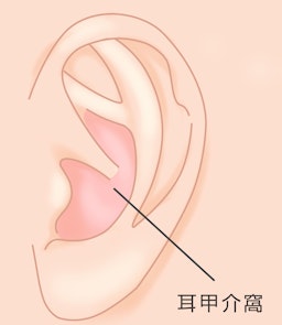 auricular1