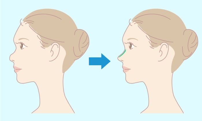 prothesis_before_after