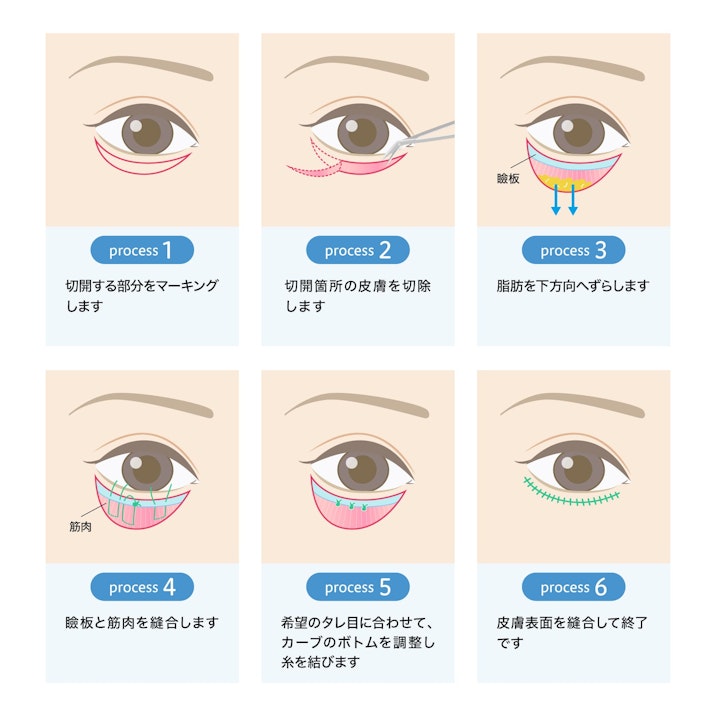 A Guide to the Downturned Eye Creation Process