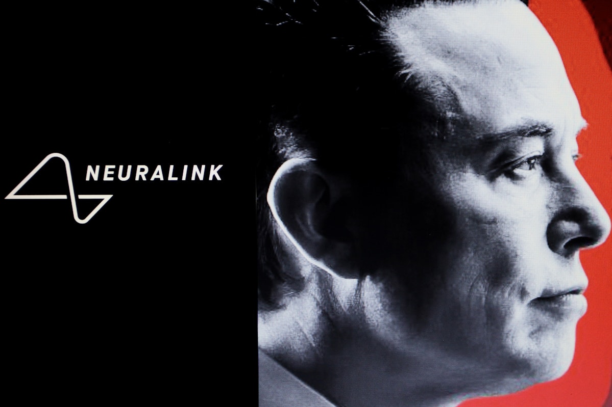 Neuralink image1