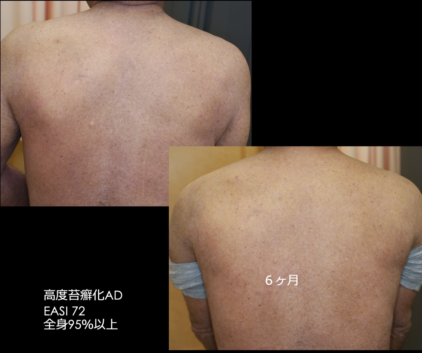アトピー性皮膚炎はこわくない ヨドバシ.com - アトピー性皮膚炎はこわくない―アトピーが治ら