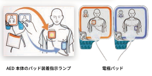 AEDのパッド装着指示ランプと電極パッド