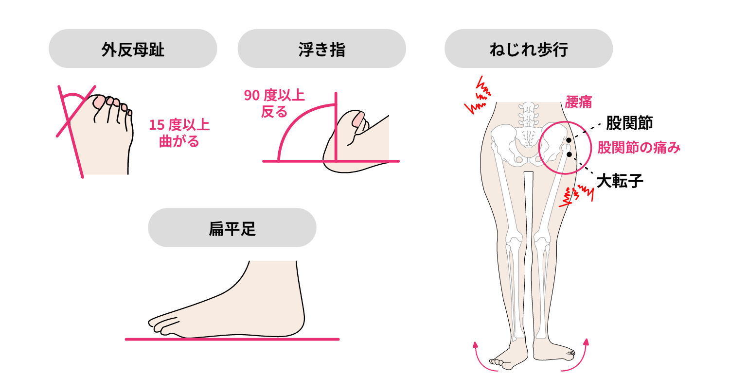 o 脚 治し 方
