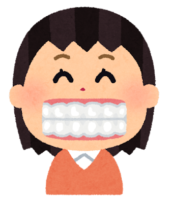 透明なマウスピース型矯正装置を装着した女性のイラスト