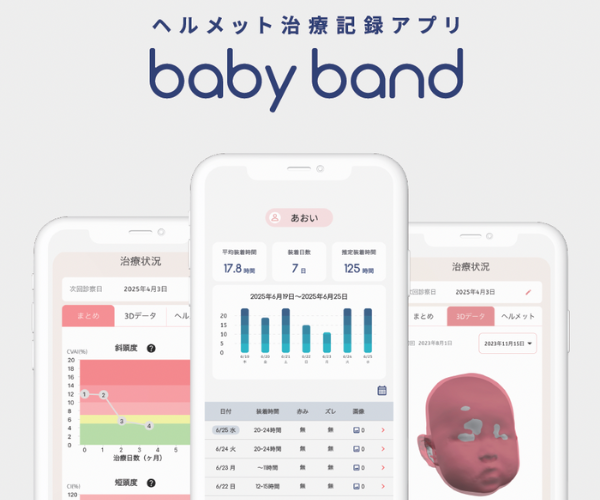 ヘルメット治療記録アプリ