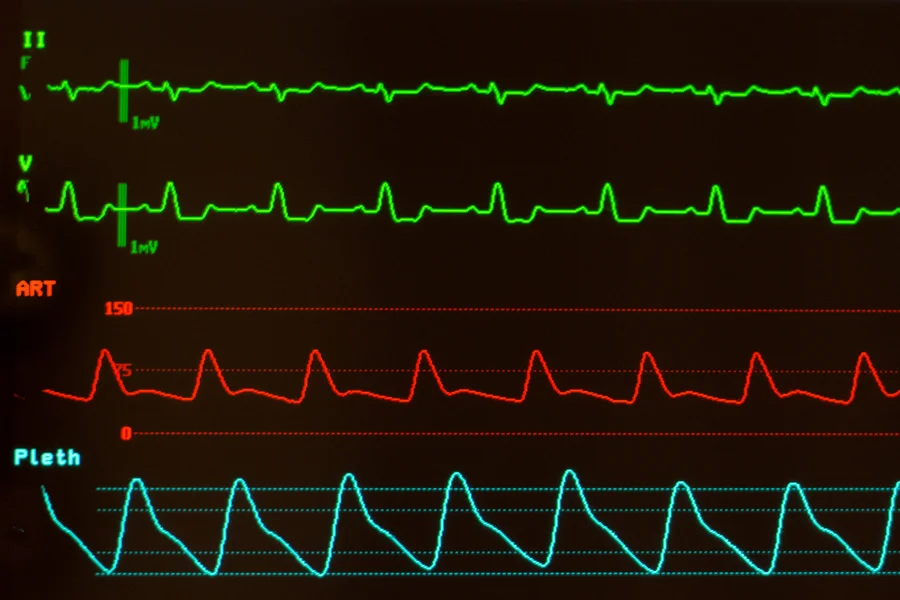 有酸素運動での目標心拍数は計算式で求められます
