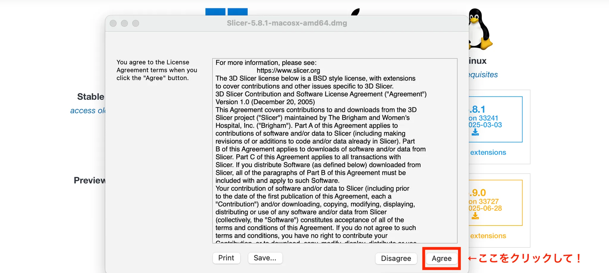 3D Slicer徹底解説！確認からセグメンテーションまで医療画像用の処理ツールを実際につかってみよう！ 本文画像5