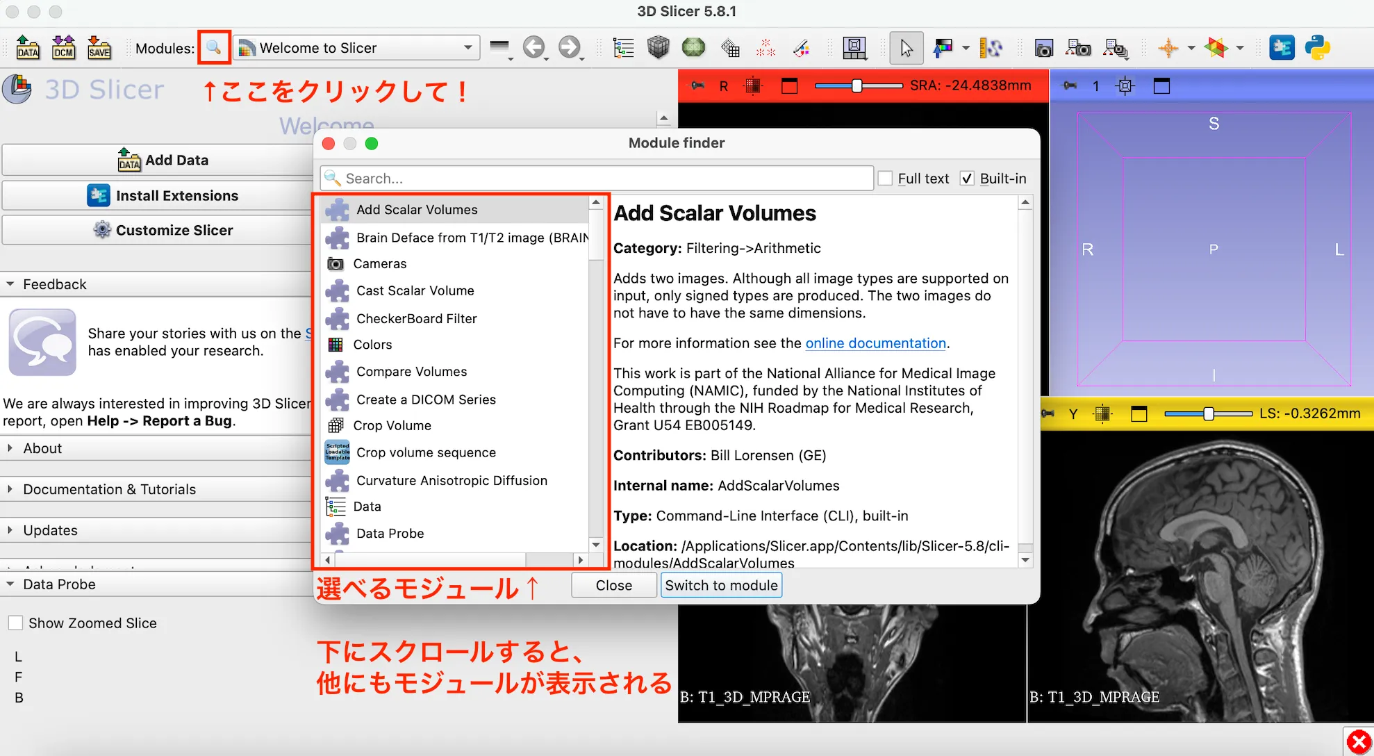 3D Slicer徹底解説！確認からセグメンテーションまで医療画像用の処理ツールを実際につかってみよう！ 本文画像11
