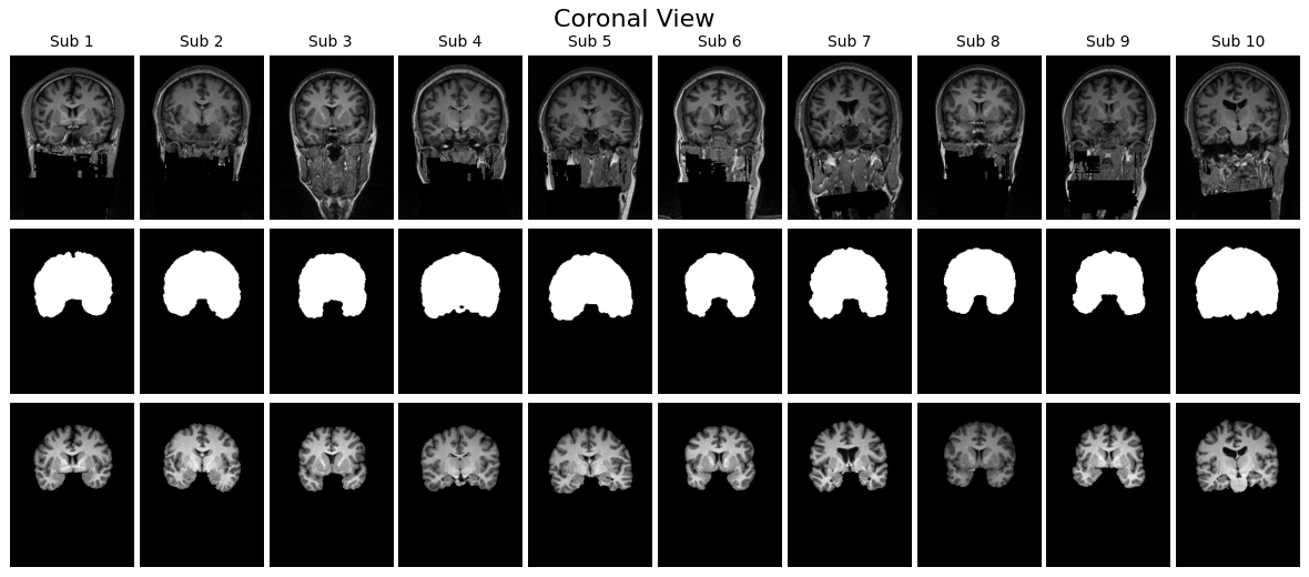 【skull-stripping入門】脳MRIから頭蓋骨を除去！Pythonで実装する手法を解説 本文画像4