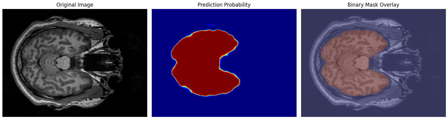 【skull-stripping入門】脳MRIから頭蓋骨を除去！Pythonで実装する手法を解説 本文画像6