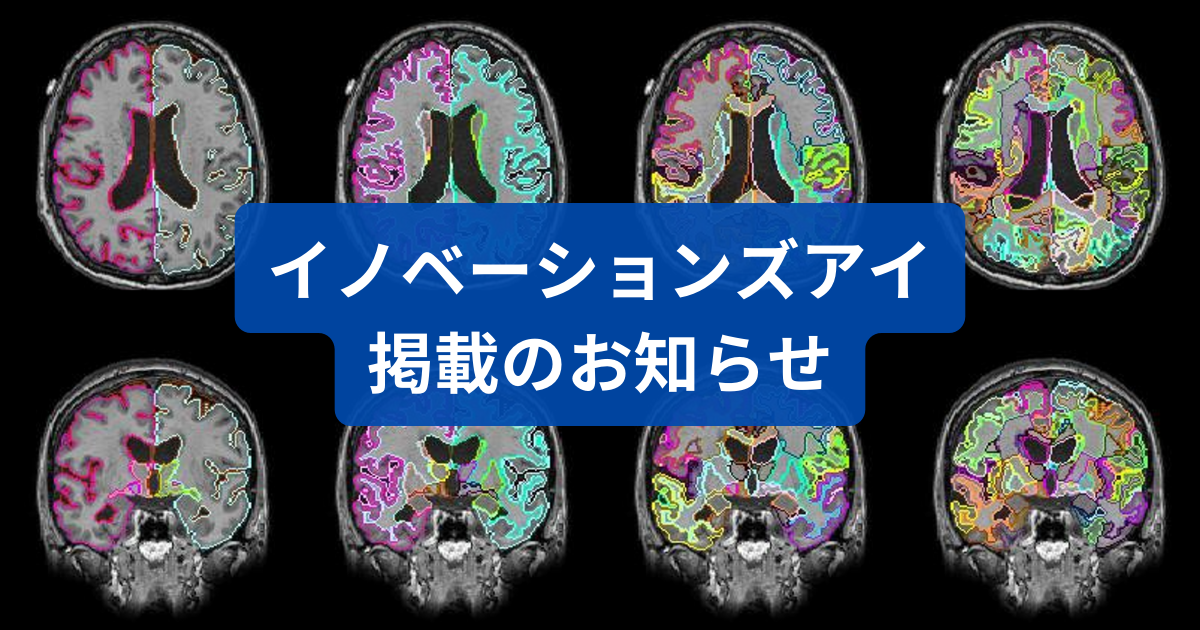 イノベーションズアイ掲載のお知らせ