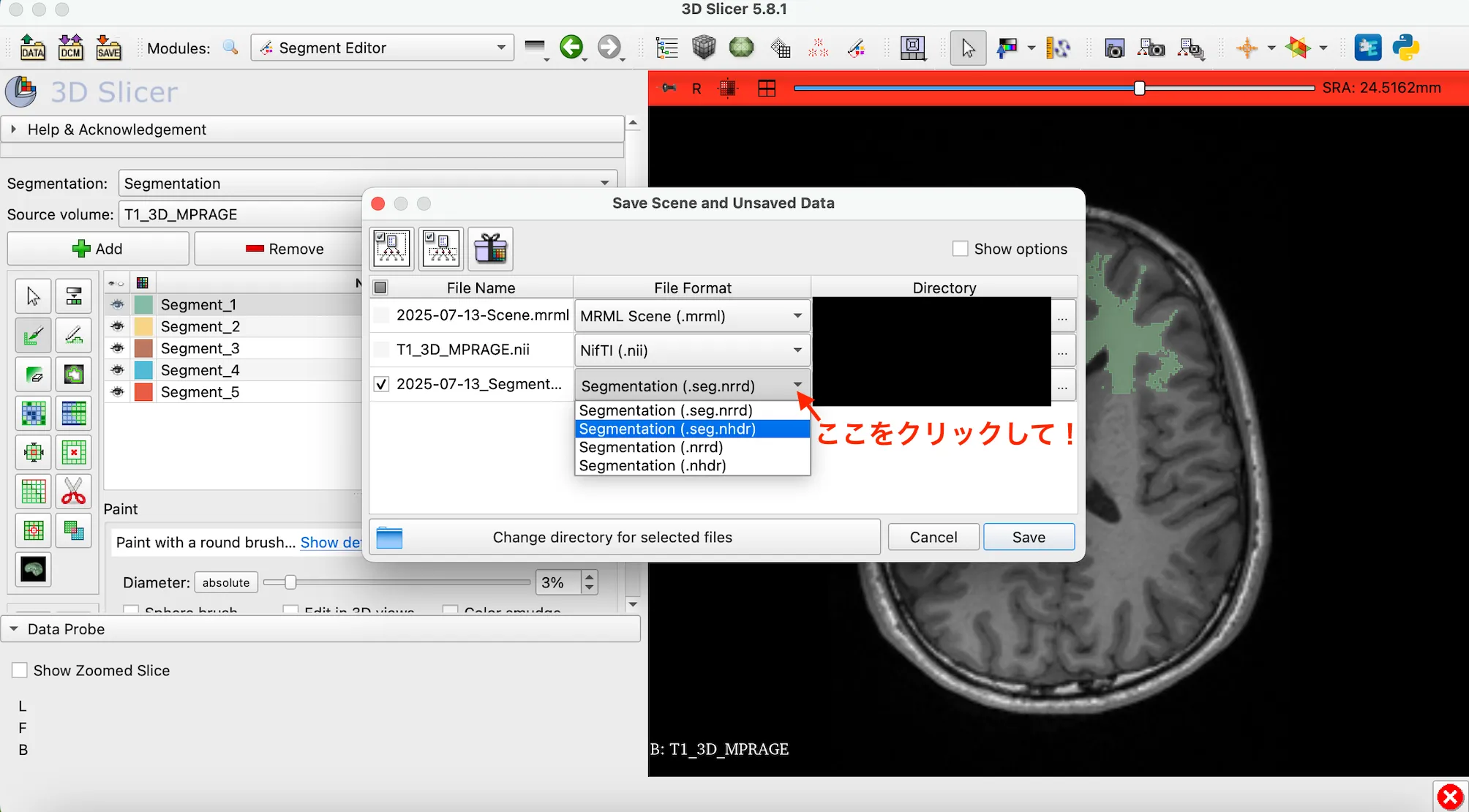 3D Slicer徹底解説！確認からセグメンテーションまで医療画像用の処理ツールを実際につかってみよう！ 本文画像31