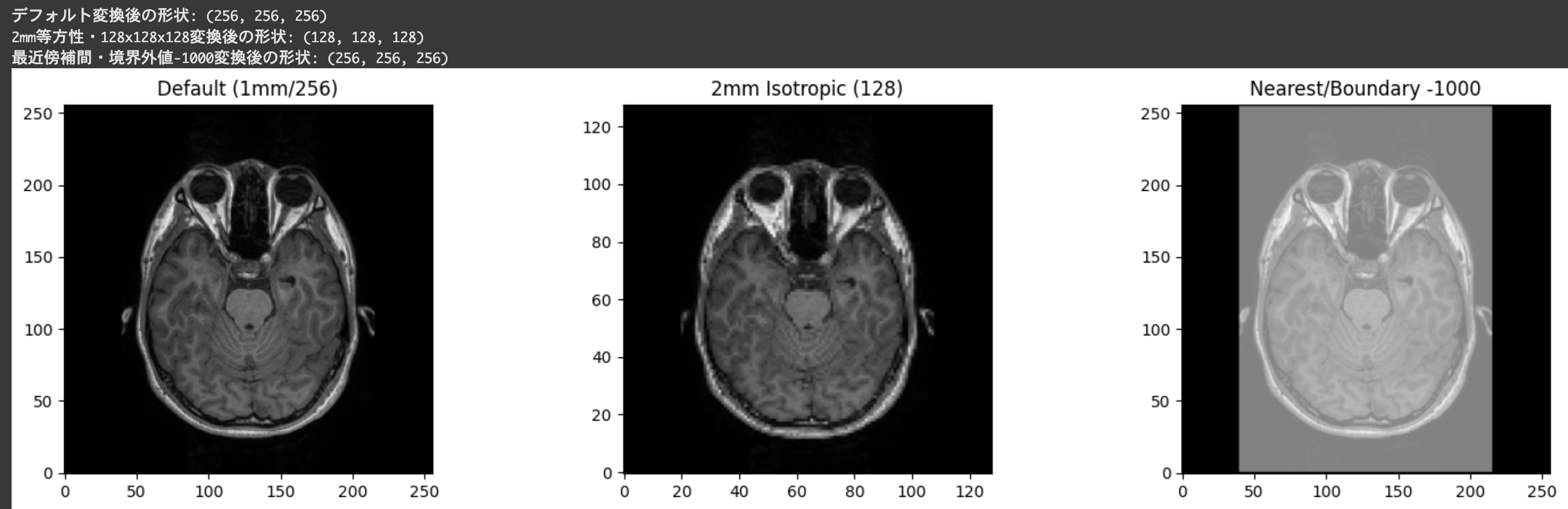 NiBabel徹底入門！Pythonで医療画像処理を実践しよう conform実行結果