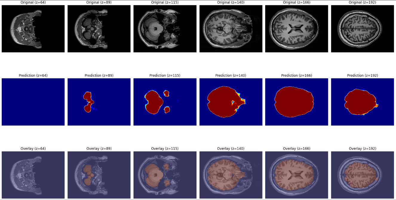 【skull-stripping入門】脳MRIから頭蓋骨を除去！Pythonで実装する手法を解説 本文画像7