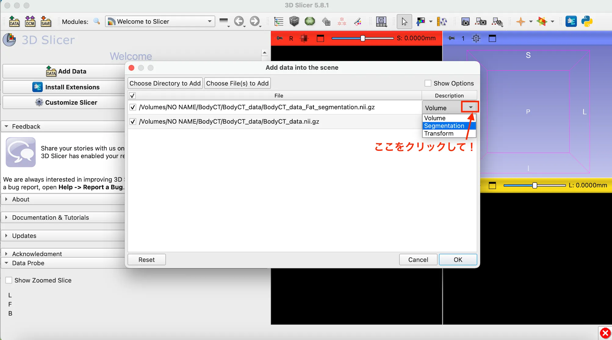 3D Slicer徹底解説！確認からセグメンテーションまで医療画像用の処理ツールを実際につかってみよう！ 本文画像33
