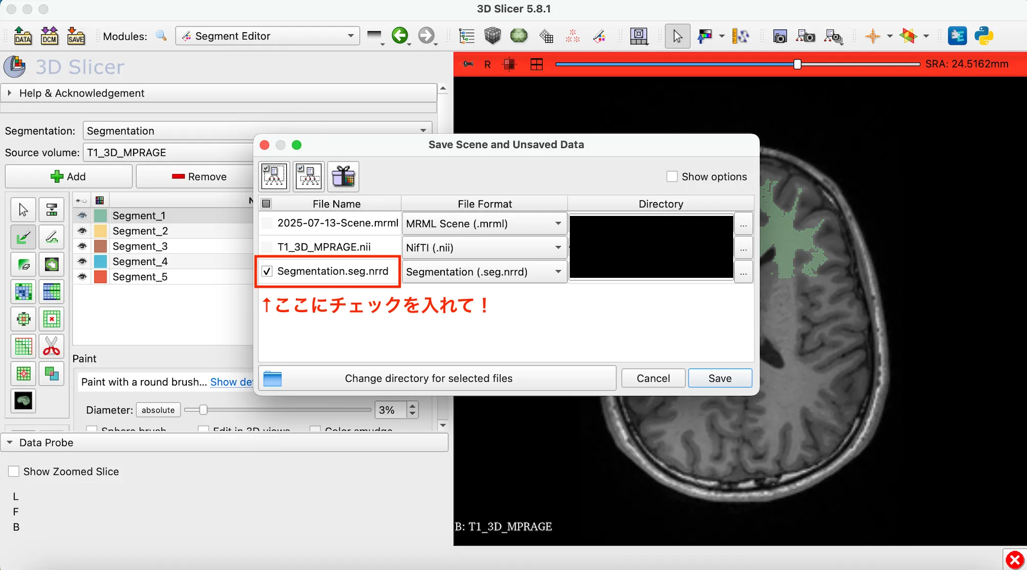 3D Slicer徹底解説！確認からセグメンテーションまで医療画像用の処理ツールを実際につかってみよう！ 本文画像29