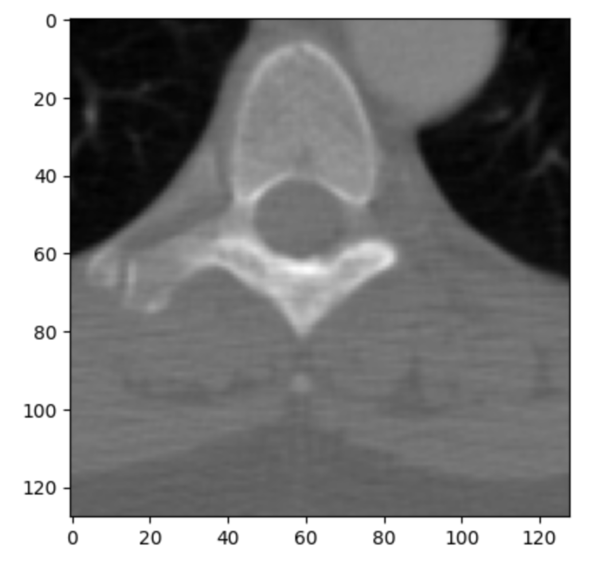 【DICOM処理入門】PythonライブラリPydicomで読み込み・編集・匿名化・画像抽出まで実装しよう! 本文画像3