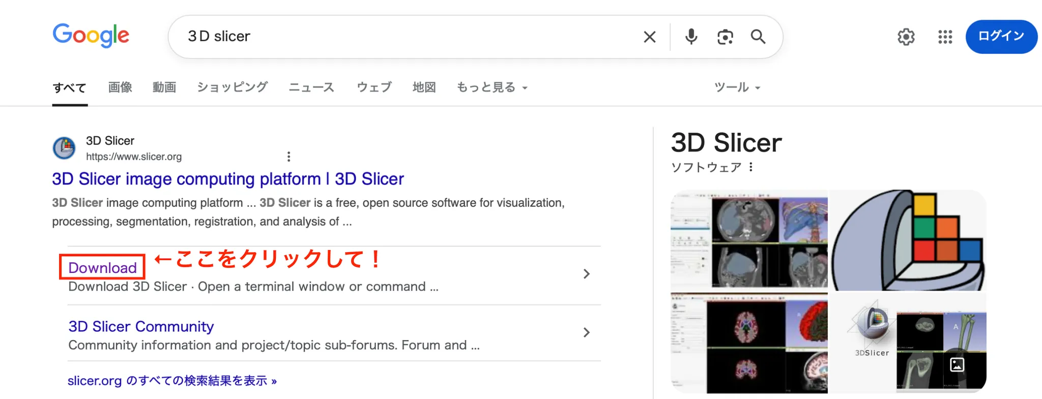 3D Slicer徹底解説！確認からセグメンテーションまで医療画像用の処理ツールを実際につかってみよう！ 本文画像2