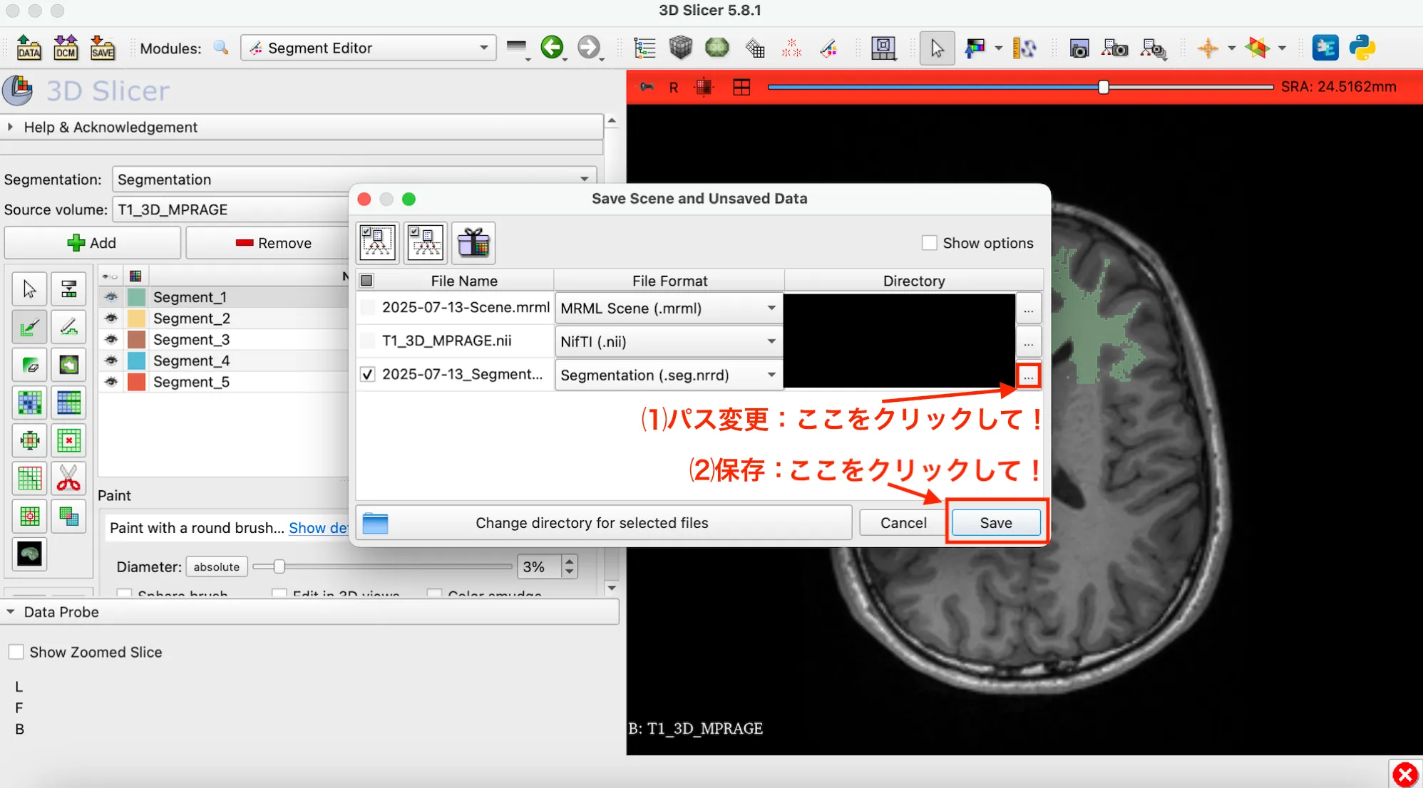 3D Slicer徹底解説！確認からセグメンテーションまで医療画像用の処理ツールを実際につかってみよう！ 本文画像32