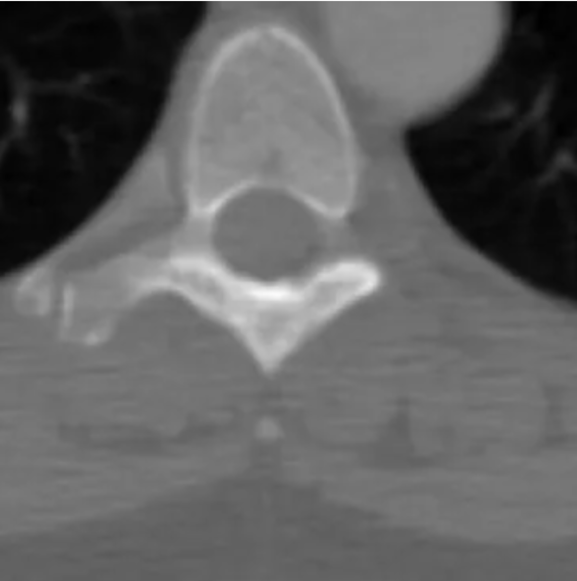 【DICOM処理入門】PythonライブラリPydicomで読み込み・編集・匿名化・画像抽出まで実装しよう! 本文画像2