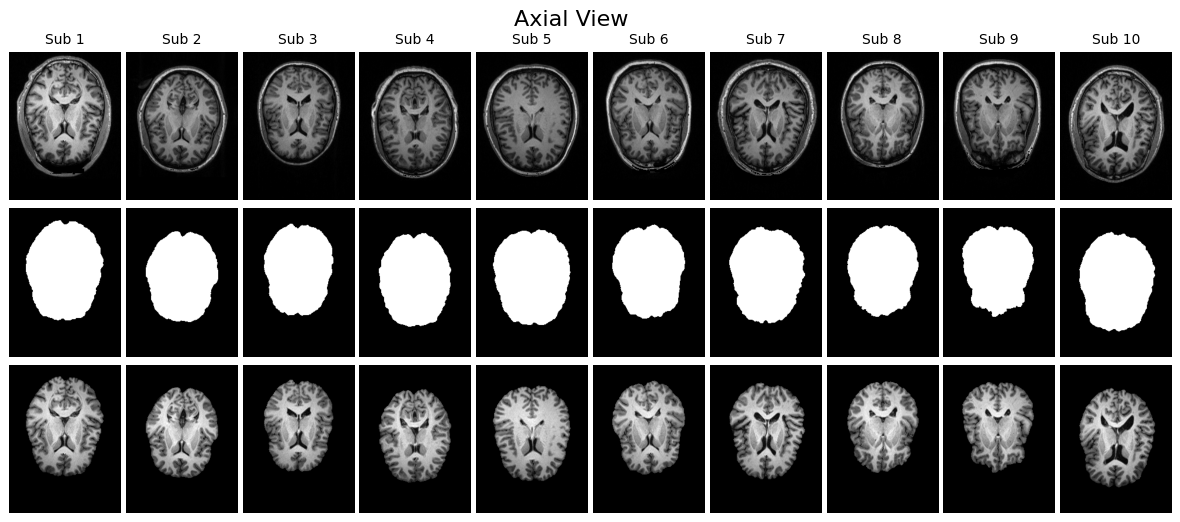 【skull-stripping入門】脳MRIから頭蓋骨を除去！Pythonで実装する手法を解説 本文画像2