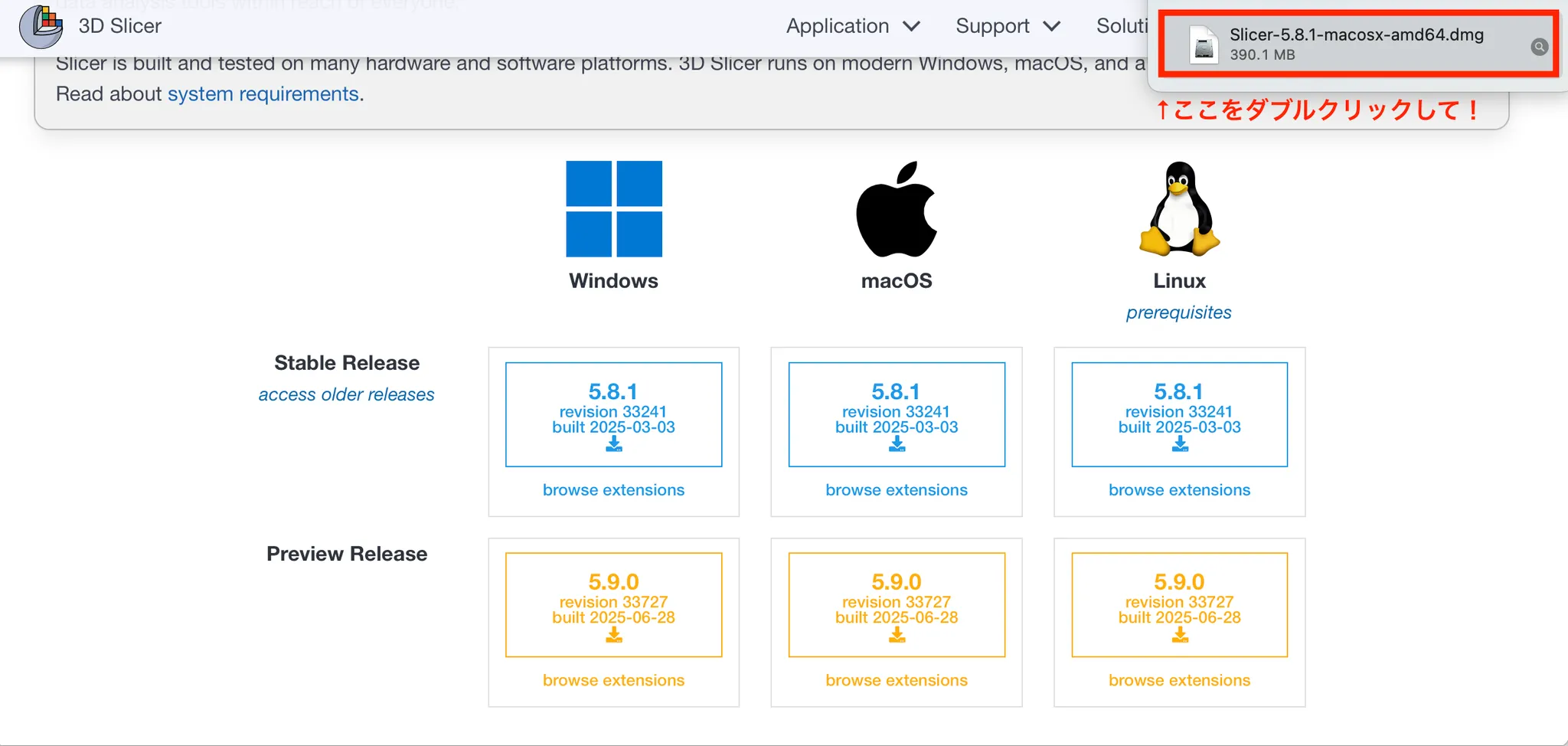 3D Slicer徹底解説！確認からセグメンテーションまで医療画像用の処理ツールを実際につかってみよう！ 本文画像4