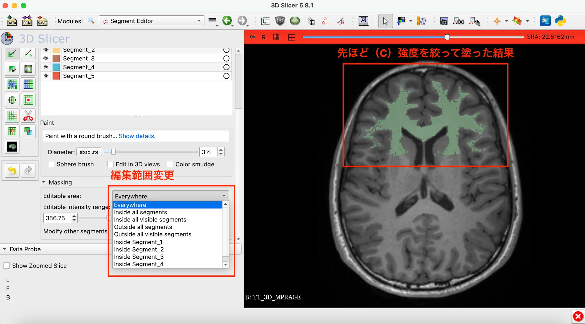 3D Slicer徹底解説！確認からセグメンテーションまで医療画像用の処理ツールを実際につかってみよう！ 本文画像21