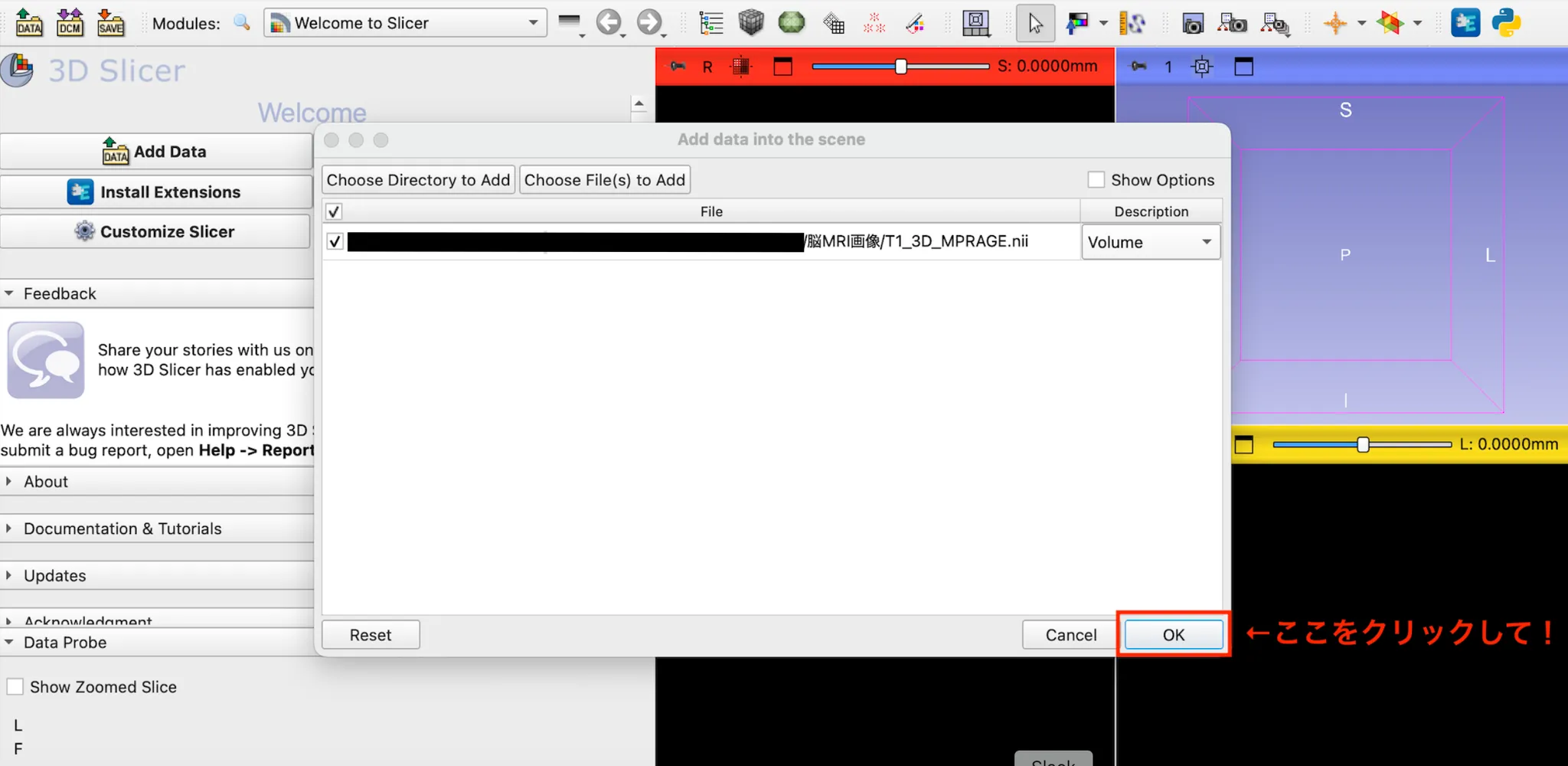 3D Slicer徹底解説！確認からセグメンテーションまで医療画像用の処理ツールを実際につかってみよう！ 本文画像9