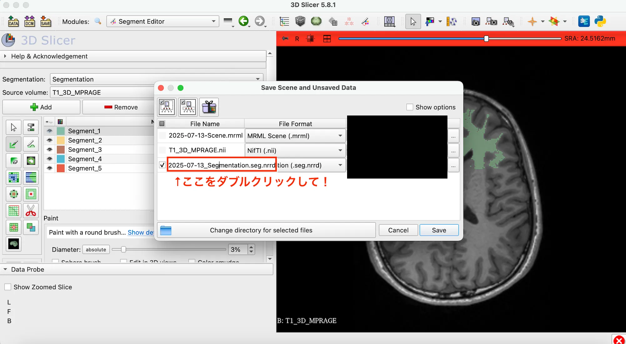 3D Slicer徹底解説！確認からセグメンテーションまで医療画像用の処理ツールを実際につかってみよう！ 本文画像30