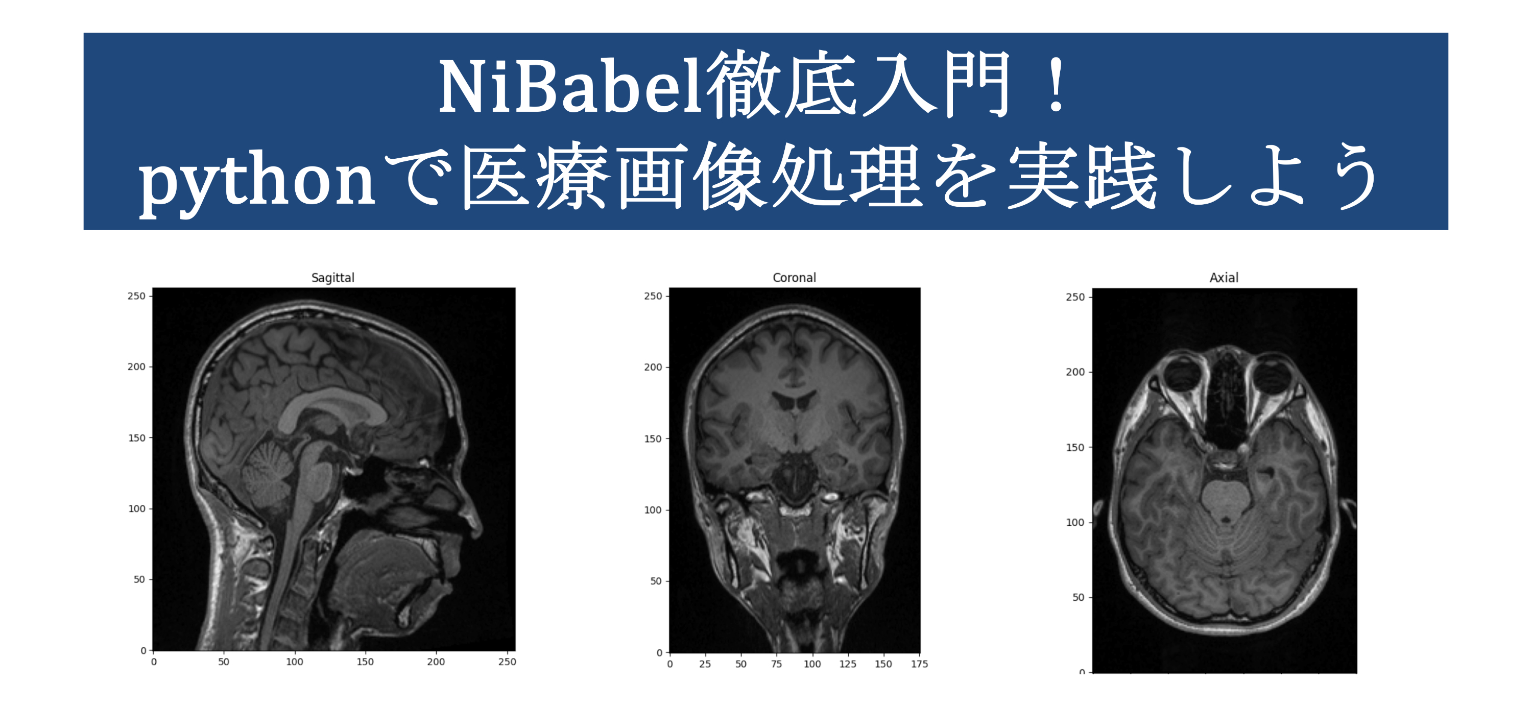 NiBabel徹底入門！Pythonで医療画像処理を実践しよう