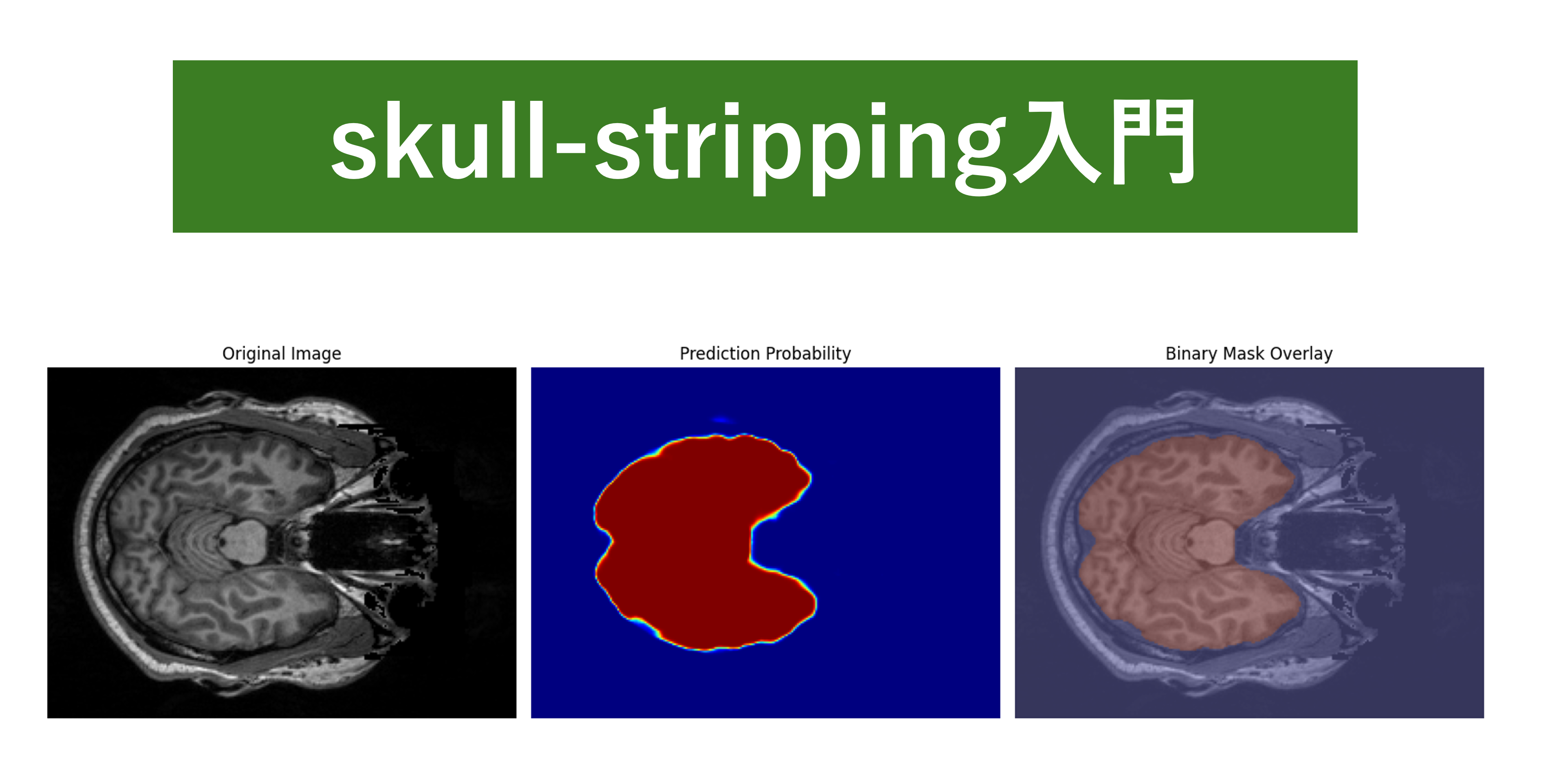 【skull-stripping入門】脳MRIから頭蓋骨を除去！Pythonで実装する手法を解説