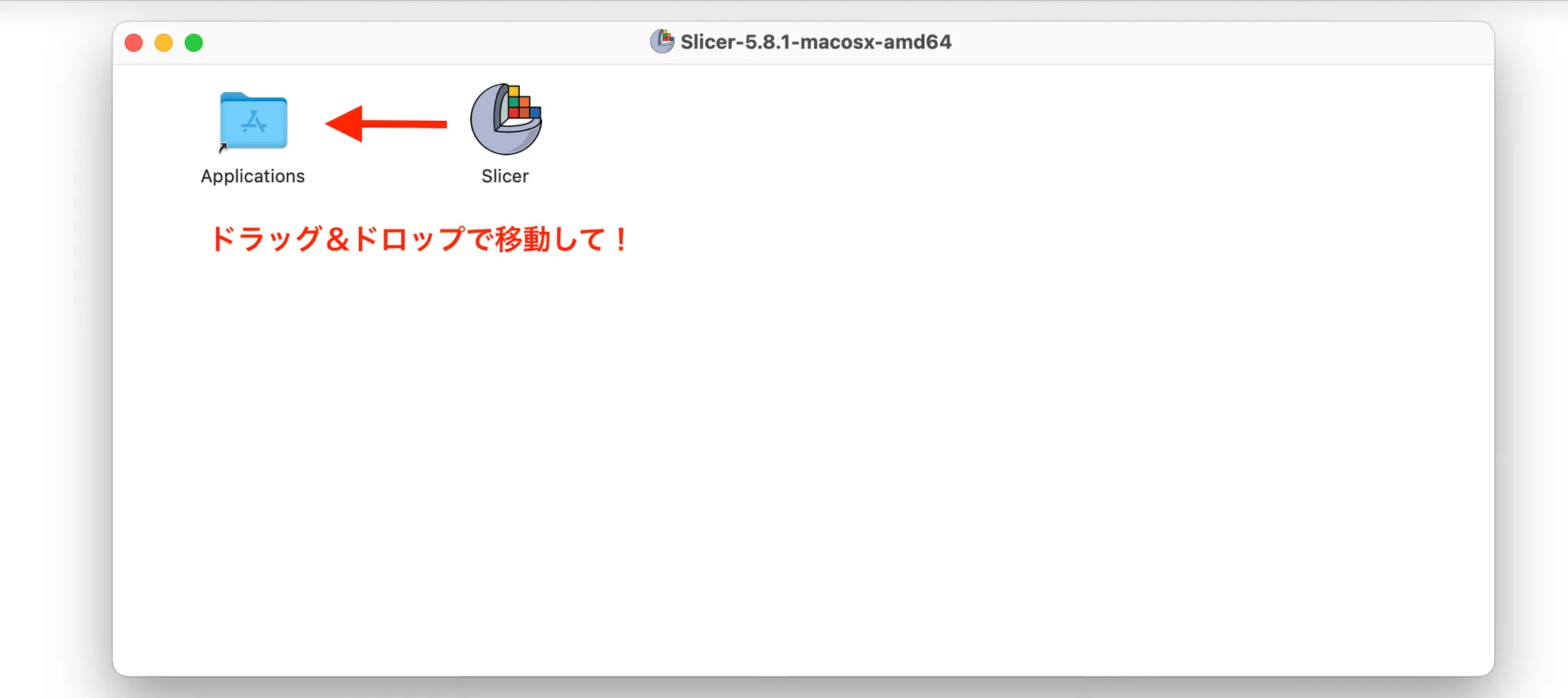 3D Slicer徹底解説！確認からセグメンテーションまで医療画像用の処理ツールを実際につかってみよう！ 本文画像6