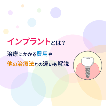 インプラントとは？治療にかかる費用や他の治療法との違いも解説