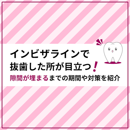 インビザラインで抜歯した所が目立つ 隙間が埋まるまでの期間や対策を紹介 歯医者予約ならmedee