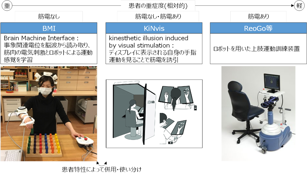 脳卒中後遺症者へのニューロリハビリテーション　計4巻セット Amazon.co.jp: 脳卒中後遺症者へのニューロリハビリテーション