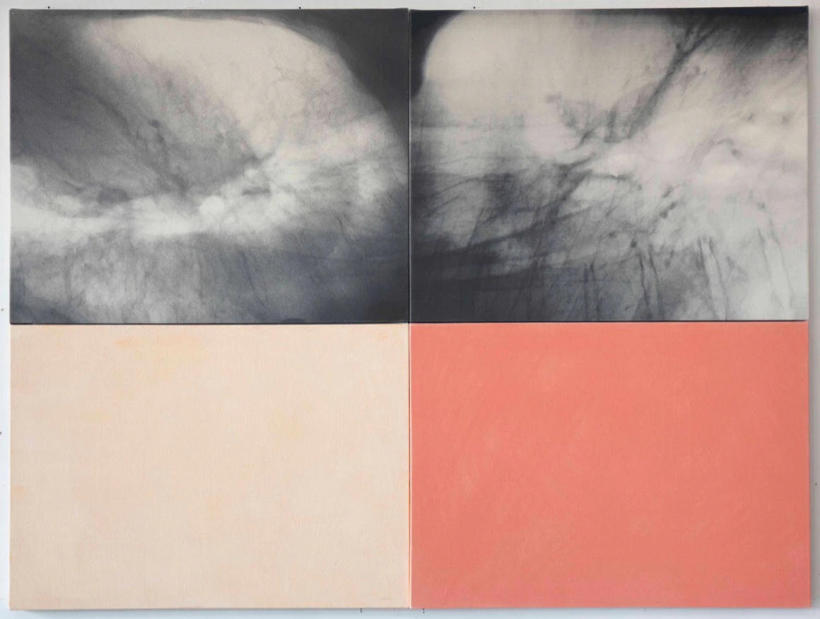 Kunié Sugiura, “Fever”, 2021, pigment print, acrylic on canvas, 106.6 x 142.2 cm © Kunié Sugiura / Courtesy of Taka Ishii Gallery