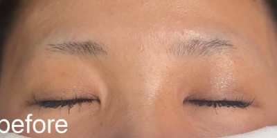 Before