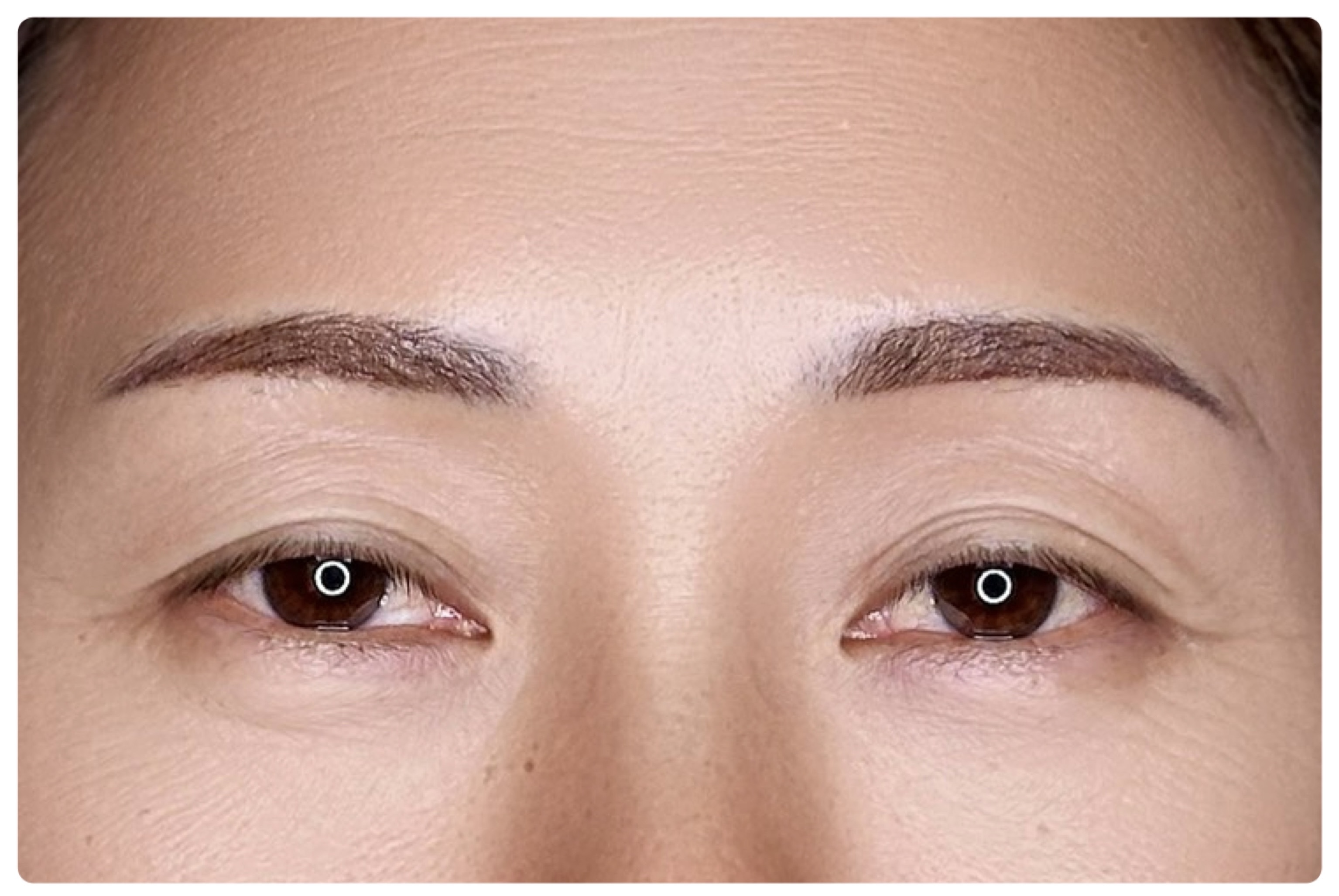 アイラインアートメイクの施術前（Before）
