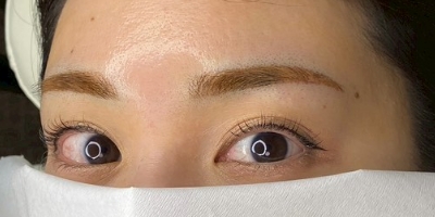 After