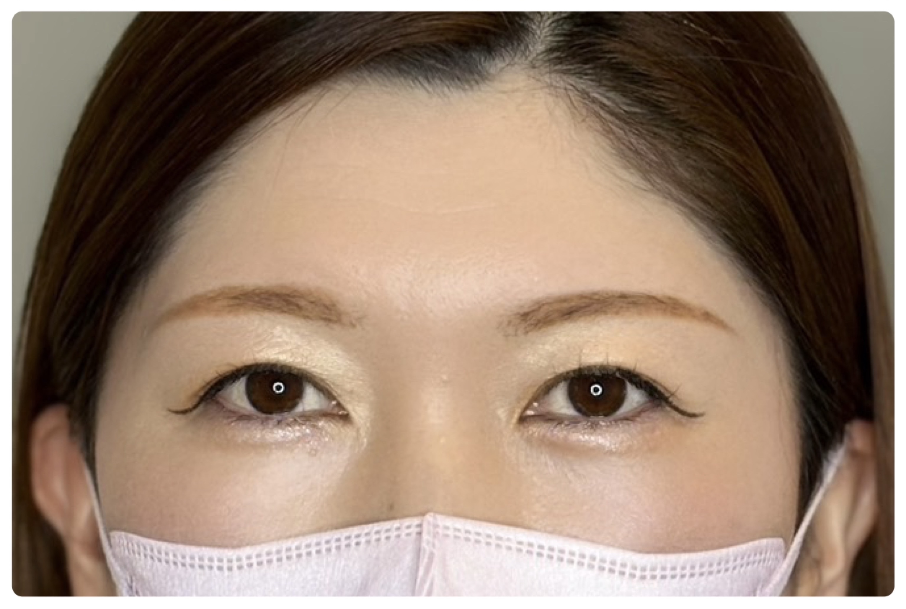ブロウ(眉)アートメイクの施術後（After・1回目施術後）