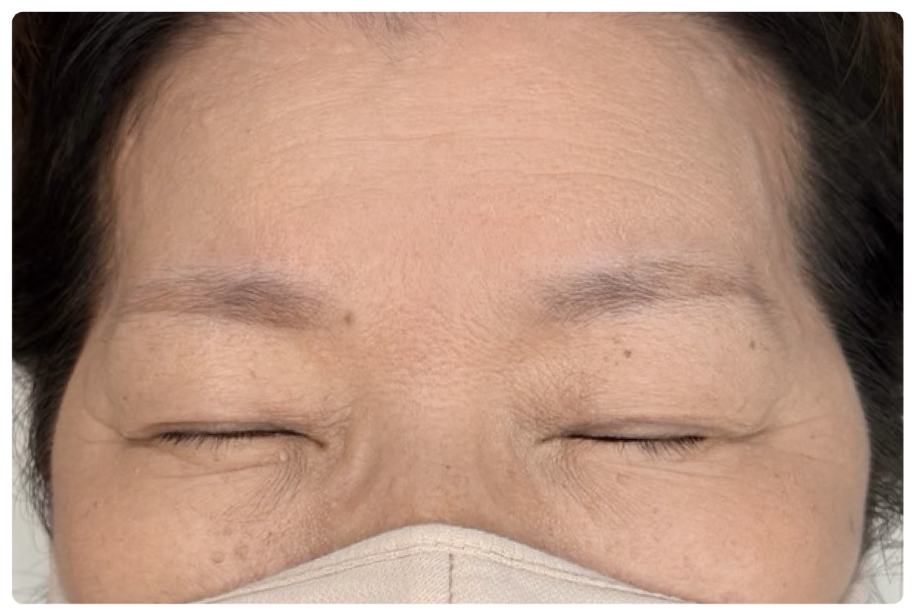 ブロウ(眉)アートメイクの施術前（Before）